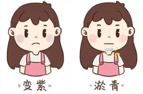 中医体质辨识仪器浅析容易淤青当心是血瘀体质